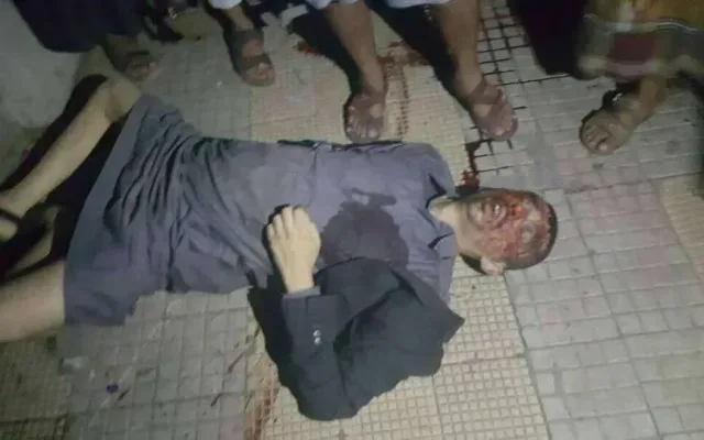 صور من مقتل خالد الرضي في إشتباكات جولة المصباحي وبيان المؤتمر حول مقتله