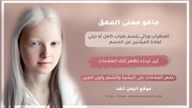 معنى المهق jpg | معنى المهق وماهي أعراض المهاق وأين يبداء اليوم العالمي لـ المهق