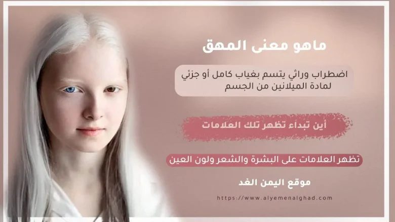 معنى المهق jpg | معنى المهق وماهي أعراض المهاق وأين يبداء اليوم العالمي لـ المهق