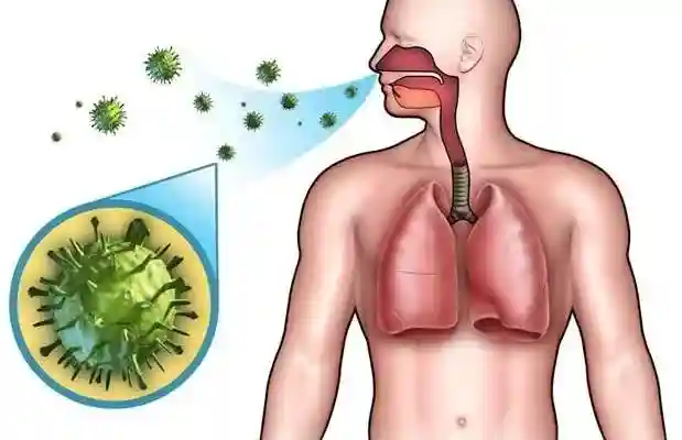 ماهو مرض وباء الدفتيريا ” الخناق ” Diphtheria