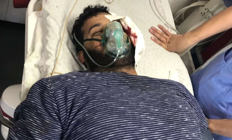 اصابة المصور الصحفي عطية درويش اليوم في غزة 1 9fV2K