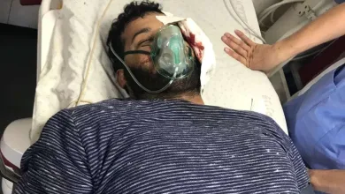 9fV2K jpg | اصابة المصور الصحفي عطية درويش اليوم في غزة