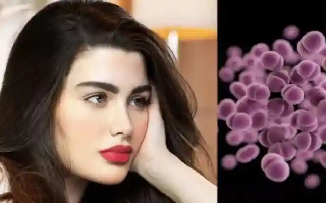 ما الورم الحليمي البشري الذي نقله زوج روان بن حسين لها؟