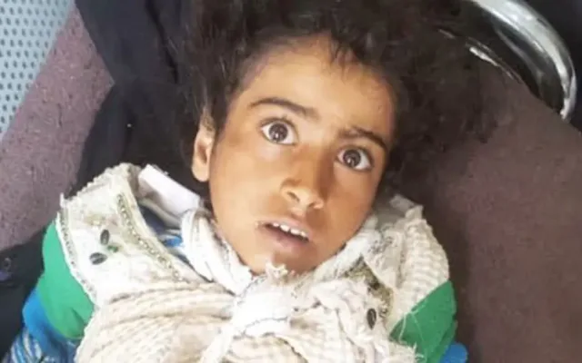 ماهي قصة الطفلة اصيله وماهو سبب مقتل الطفلة اليمنية أصيلة