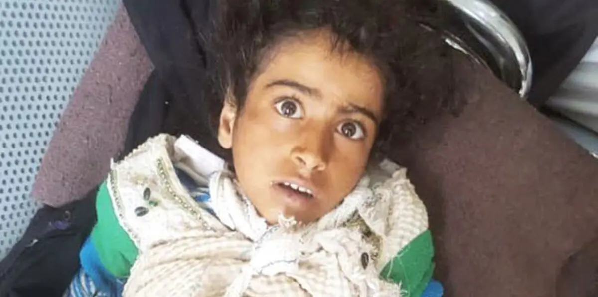 ماهي قصة الطفلة اصيله وماهو سبب مقتل الطفلة اليمنية أصيلة ماهي قصة الطفلة اصيله وماهو سبب مقتل الطفلة اليمنية أصيلة