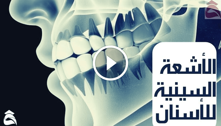 الأشعة السينية للأسنان؛ أهم 4 أنواع لها وكيف تستعد 1 الأشعة السينية للأسنان؛ أهم 4 أنواع لها وكيف تستعد