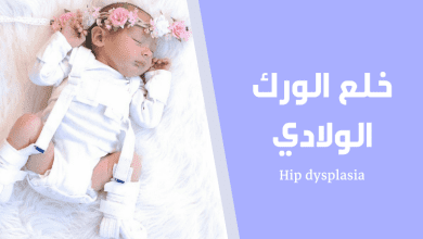 خلع الورك الولادي؛ الأسباب وطرق العلاج