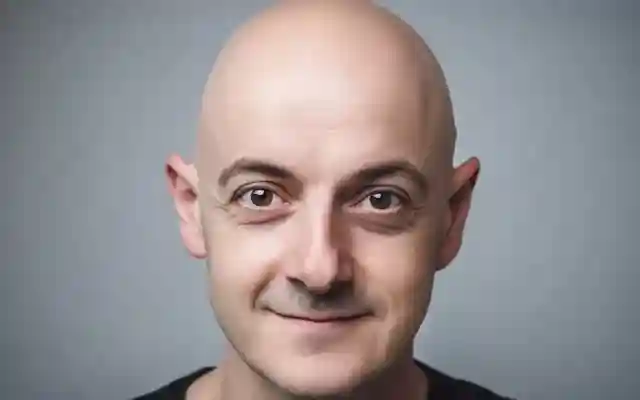 موعد اليوم العالمي للرجل الأصلع 2024