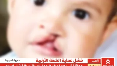 معاناة مواطن في عدن بسبب الفشل الطبي وإجراء 8 عمليات فاشلة لإبنته "الشفة الأرنبية"