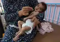 وزارة الصحة غزة : وفاة 9 فلسطينيين بسبب المجاعة بينهم طفلان