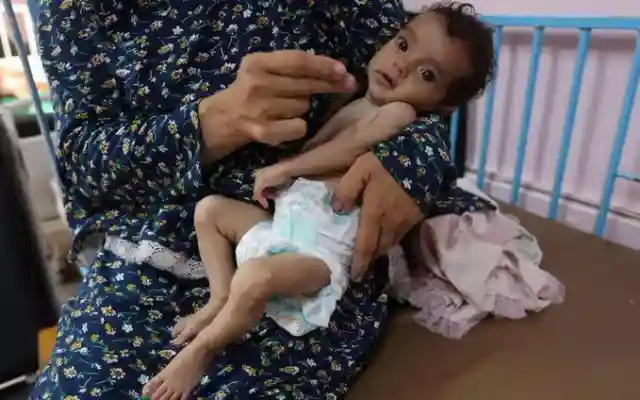 وزارة الصحة غزة : وفاة 9 فلسطينيين بسبب المجاعة بينهم طفلان