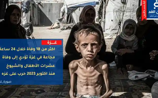 أكثر من 18 وفاة بسبب المجاعة في غزة المحاصرة