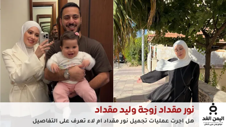 هل أجرت عملية تجميل نور مقداد زوجة وليد مقداد شاهد صور قبل وبعد 1 نور مقداد زوجة وليد