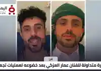 صدمة وتفاعل واسع.. ملامح جديدة للفنان عمار العزكي بعد خضوعه لعملية تجميل (صورة)